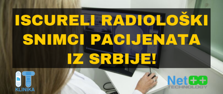 Iscureli radiološki snimci pacijenata iz Srbije!